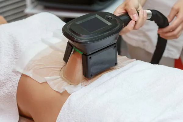 Image of person having fat freezing treatment to help weight gain Sleaford