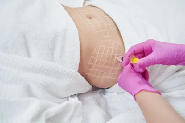 image of fat dissolving injections on love handles to help combat weight gain Sleaford