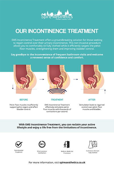 image to show how EMS treatment works for female urinary incontinence Sleaford