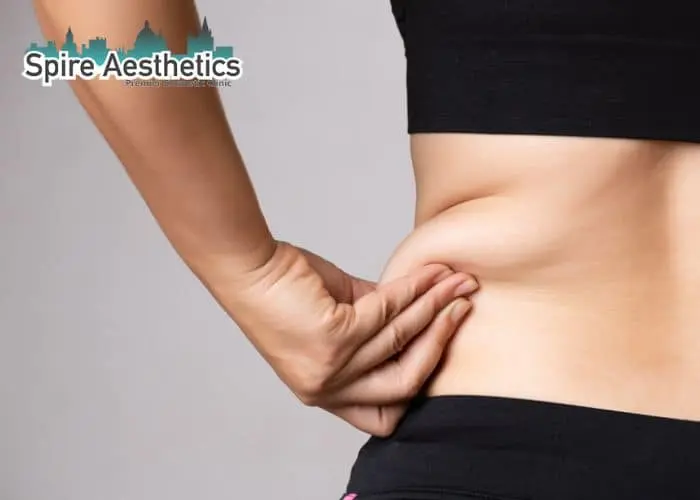 Image of woman pinching fat on their hips Sleaford. Fat Freezing treatment