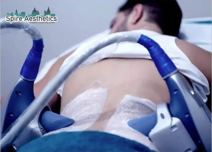 Man having fat freezing treatment done on love handles before a competitions Sleaford to create a sculpted look.