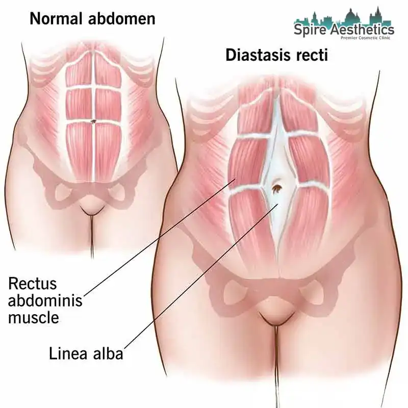 When Will My Belly Feel Normal Again Sleaford?