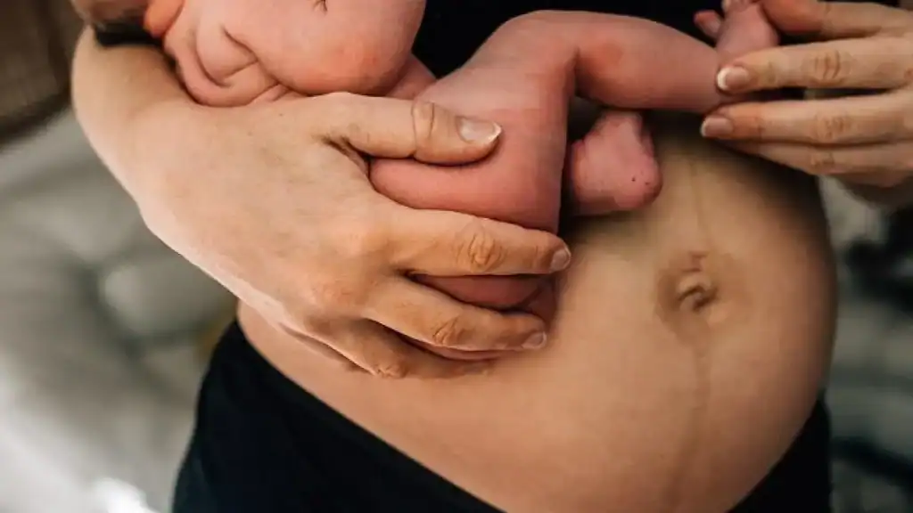 Why Is My Stomach Still Big After Pregnancy Sleaford?