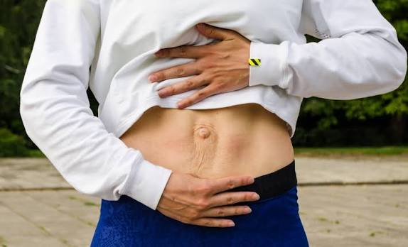 When Could Diastasis Recti Be the Missing Piece of the Puzzle Sleaford?